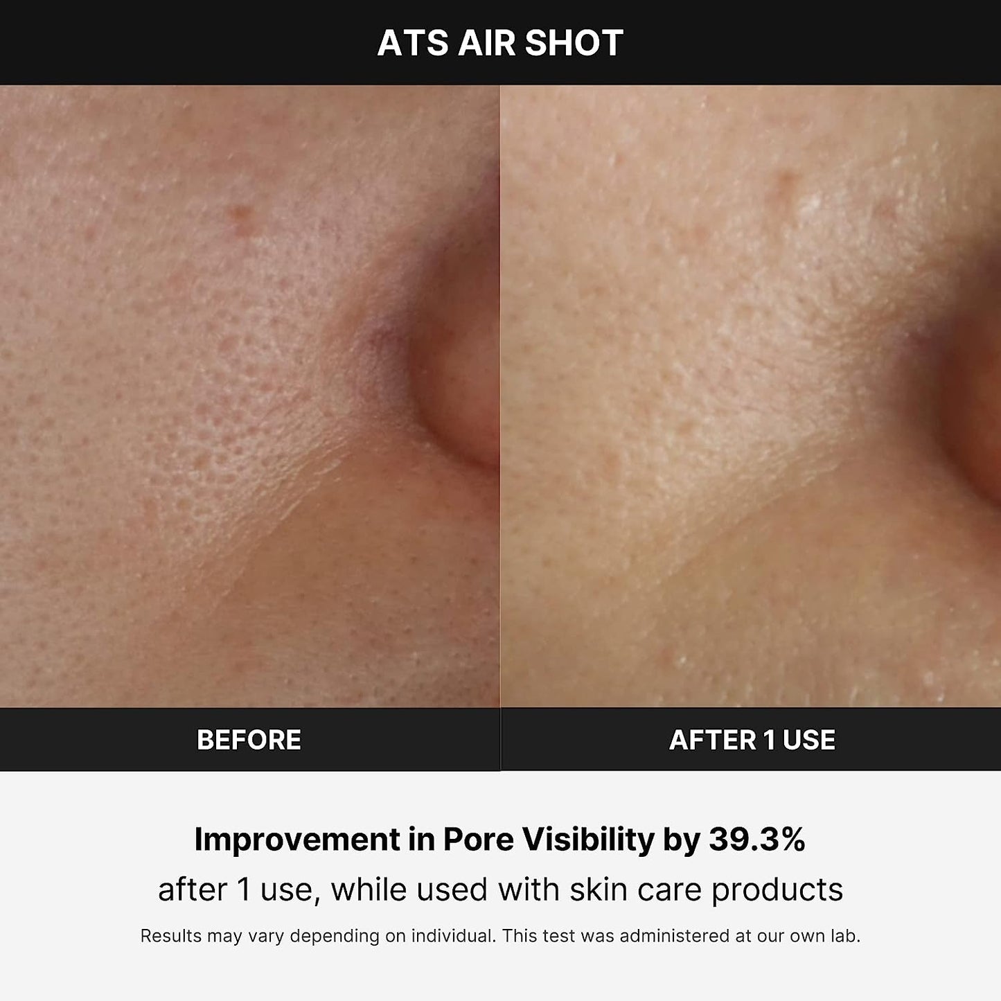 Age-R ATS Air Shot - Microneedling Pore Tightening Skin Care Device for Enhanced Absorption, Pore Refinement, and Smoother Skin Texture - Exfoliation, Skin Rejuvenation - Korean Skin Care