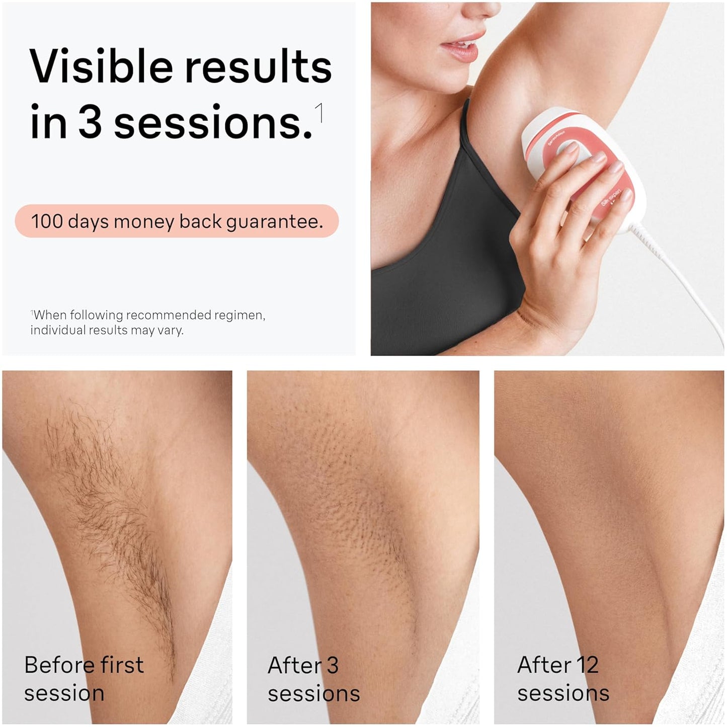 IPL at Home Laser Hair Removal for Women and Men, Silk Expert Mini PL1014 with Venus Razor, Permanent Visible Hair Reduction in Hair Regrowth for Body & Face, Corded